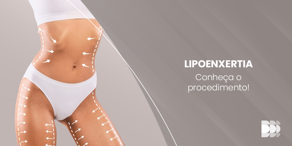 lipoenxertia - cirurgia plastica