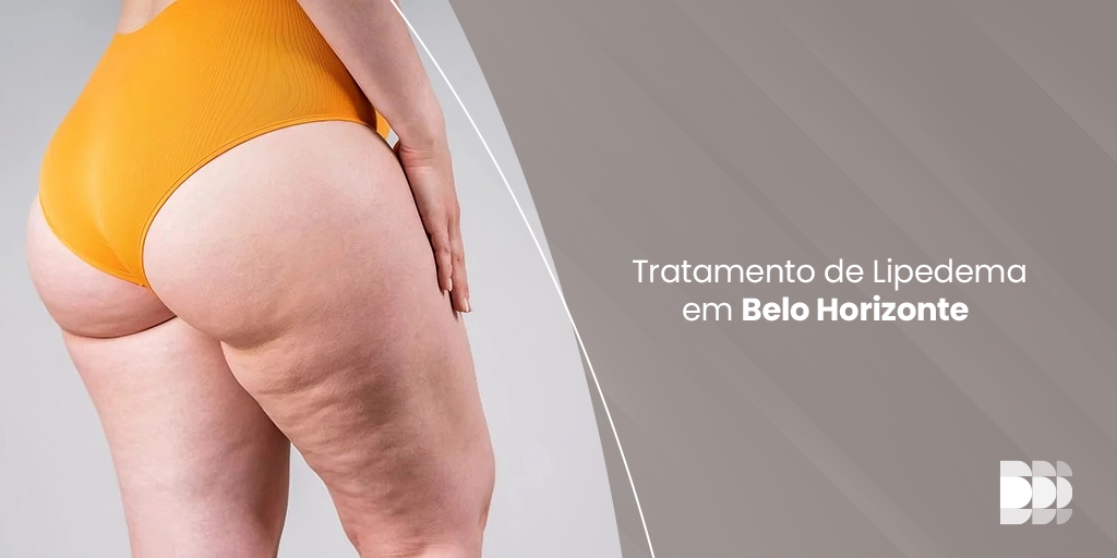 Encontre tratamento especializado para lipedema em Belo Horizonte no Núcleo DOME.