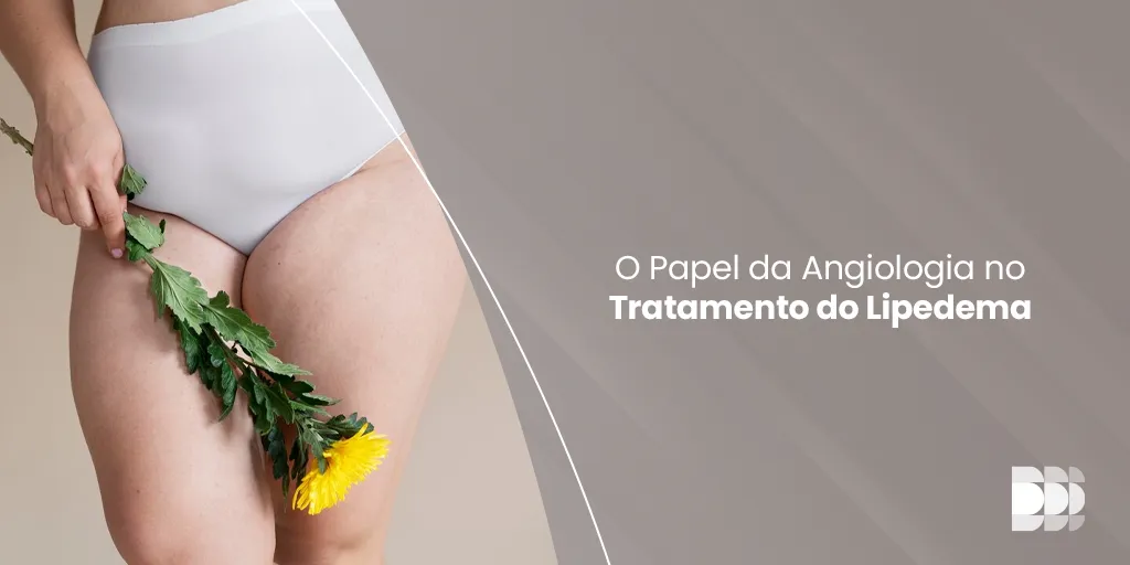 Descubra como a angiologia desempenha um papel crucial no tratamento do lipedema no Núcleo DOME em Belo Horizonte.