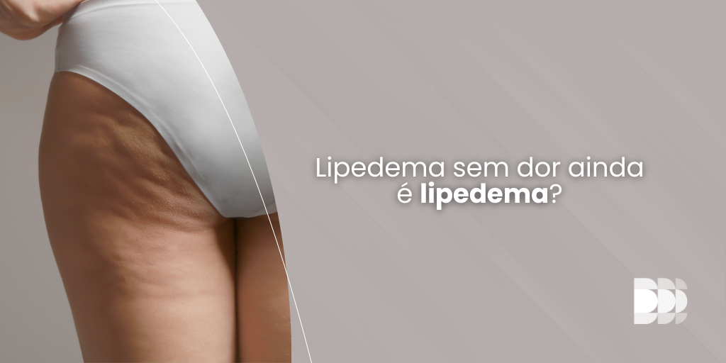 Lipedema sem dor ainda é lipedema? Avaliação especializada no Núcleo DOME identifica sinais e cuida da sua qualidade de vida.