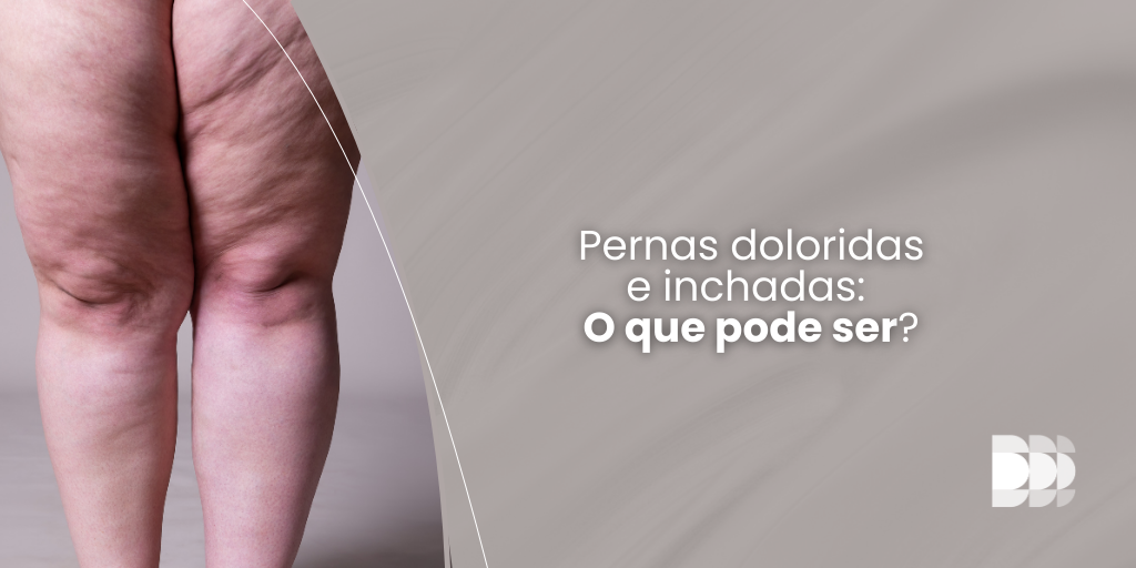 Descubra o que pode causar pernas doloridas e inchadas. Saiba mais sobre o lipedema, seus sintomas e opções de tratamento no Núcleo DOME.