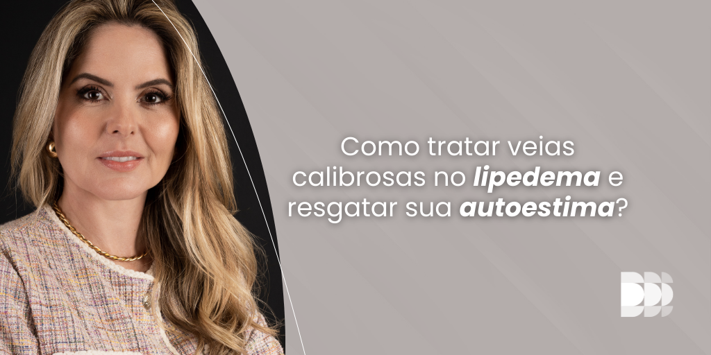 Descubra como tratar veias calibrosas no lipedema e resgatar sua autoestima com os tratamentos avançados do DOME Núcleo Avançado. Agende sua consulta com a Dra. Paola Petermann e saiba como melhorar a aparência das suas pernas.