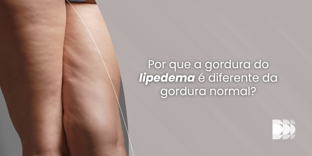 Saiba mais sobre Lipedema, cosmiatria e cirurgia plástica através do nosso BLOG! Clique no link e agende a sua consulta de avaliação!