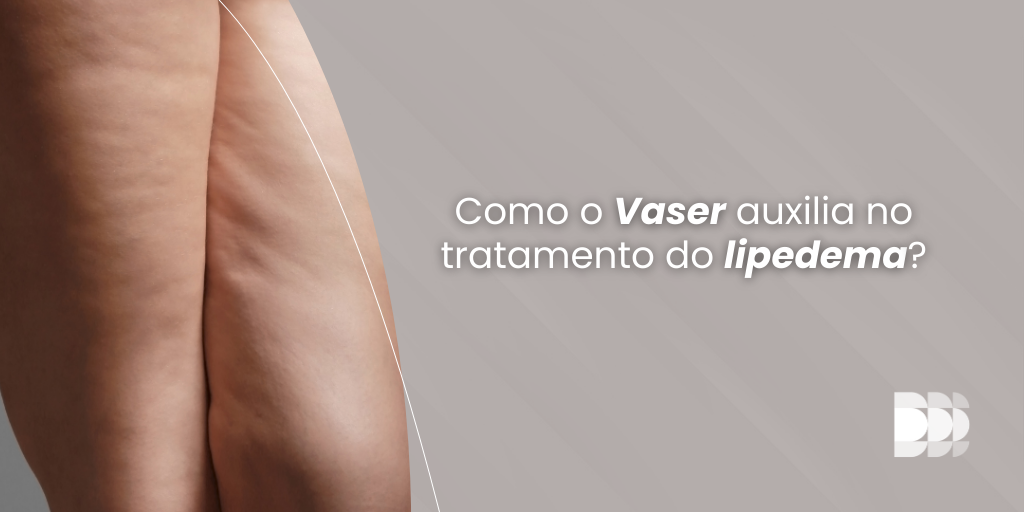 Descubra como o Vaser potencializa o tratamento do lipedema, oferecendo precisão na lipoaspiração e resultados superiores no Núcleo DOME.