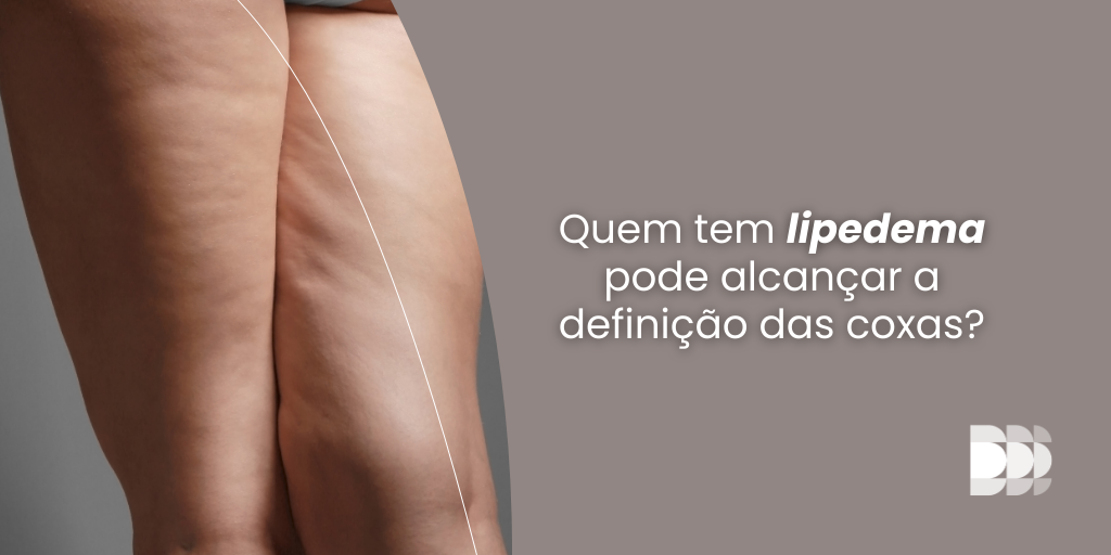 Descubra como quem tem lipedema pode alcançar a definição das coxas com segurança e eficácia. Saiba mais sobre tratamentos, cuidados e acompanhamento especializado no Núcleo DOME de Lipedema!