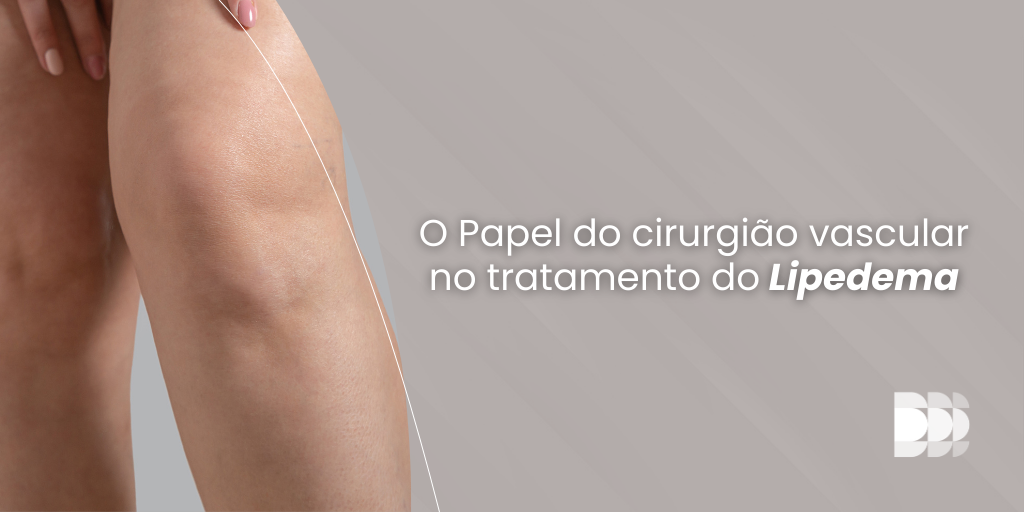 O Papel do cirurgião vascular no tratamento do Lipedema O lipedema é uma condição crônica que afeta principalmente mulheres, caracterizada pelo acúmulo desproporcional de gordura, especialmente nas pernas, causando dor intensa e sensibilidade. Esse quadro frequentemente leva os pacientes a buscarem um cirurgião vascular, uma vez que a dor nas pernas é uma queixa recorrente. Diagnóstico e tratamento do Lipedema O cirurgião vascular desempenha um papel fundamental na identificação e no tratamento do lipedema. Além da dor associada à condição, aproximadamente 50% dos pacientes também apresentam problemas circulatórios, como insuficiência venosa crônica. A presença de varizes e vasinhos é comum entre os portadores de lipedema, tornando essencial a avaliação vascular para assegurar um tratamento completo e eficaz. O objetivo é abordar tanto a insuficiência venosa quanto a inflamação da gordura, promovendo a saúde das pernas de forma integrada. Tratamento Integrado O tratamento do lipedema deve ser multidisciplinar e personalizado. O cirurgião vascular pode recomendar abordagens terapêuticas combinadas, que incluem: Tratamento da insuficiência venosa, como escleroterapia ou cirurgia para varizes; Terapias para reduzir a inflamação da gordura, como drenagem linfática e uso de meias de compressão; Mudanças no estilo de vida, incluindo alimentação anti-inflamatória e exercícios físicos específicos. Essa abordagem integrada assegura um alívio mais efetivo dos sintomas e uma melhora significativa na qualidade de vida dos pacientes. Quando procurar um cirurgião vascular? Se você sente dores persistentes nas pernas, tem inchaço frequente, observa o aumento desproporcional de gordura nas pernas e apresenta sintomas compatíveis com lipedema, é fundamental procurar um especialista em doenças vasculares. O cuidado com a saúde vascular é essencial para um tratamento bem-sucedido, promovendo bem-estar e qualidade de vida. Agende uma avaliação com um cirurgião vascular e cuide da saúde das suas pernas!