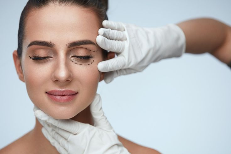 Imagem ilustrativa de cirurgia das pálpebras blefaroplastia, destacando a região dos olhos e relacionada à avaliação de quem pode ser candidato ao procedimento.